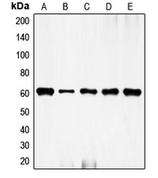 FOS / c-FOS Antibody - Western blot analysis of c-FOS expression in HeLa (A); NIH3T3 (B); mouse brain (C); rat kidney (D); rat brain (E) whole cell lysates.
