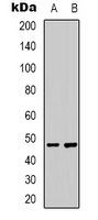 FOS / c-FOS Antibody - Western blot analysis of c-FOS (pS32) expression in Jurkat (A); HepG2 (B) whole cell lysates.