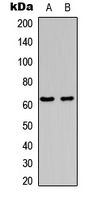 FOS / c-FOS Antibody - Western blot analysis of c-FOS (pS362) expression in HepG2 (A); HeLa Adriamycin-treated (B) whole cell lysates.