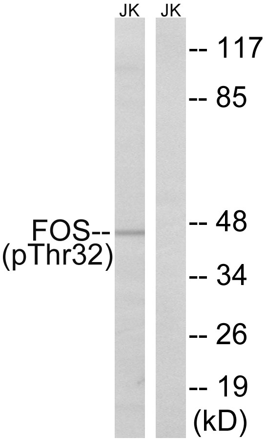 FOS / c-FOS Antibody - Western blot analysis of lysates from Jurkat cells treated with starved 24h, using FOS (Phospho-Ser32) Antibody. The lane on the right is blocked with the phospho peptide.