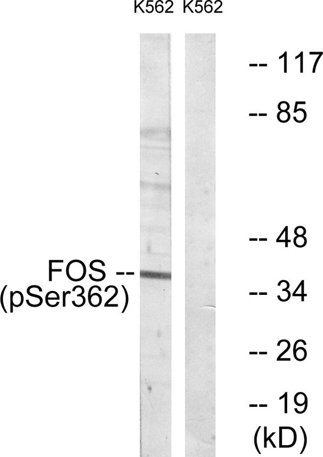 FOS / c-FOS Antibody - Western blot analysis of lysates from K562 cells treated with forskolin 40nM 30', using Fos (Phospho-Ser362) Antibody. The lane on the right is blocked with the phospho peptide.