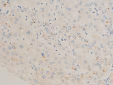 FOS / c-FOS Antibody - 1:100 staining human liver tissue by IHC-P. The tissue was formaldehyde fixed and a heat mediated antigen retrieval step in citrate buffer was performed. The tissue was then blocked and incubated with the antibody for 1.5 hours at 22°C. An HRP conjugated goat anti-rabbit antibody was used as the secondary.