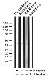 FOS / c-FOS Antibody - Western blot analysis of Phospho-Fos (Ser362) expression in various lysates