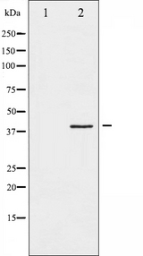 FOS / c-FOS Antibody - Western blot analysis of Fos phosphorylation expression in forskolin treated K562 whole cells lysates. The lane on the left is treated with the antigen-specific peptide.