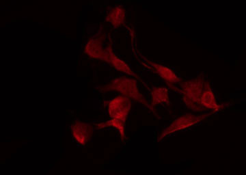 FOS / c-FOS Antibody - Staining K562 cells by IF/ICC. The samples were fixed with PFA and permeabilized in 0.1% Triton X-100, then blocked in 10% serum for 45 min at 25°C. The primary antibody was diluted at 1:200 and incubated with the sample for 1 hour at 37°C. An Alexa Fluor 594 conjugated goat anti-rabbit IgG (H+L) Ab, diluted at 1/600, was used as the secondary antibody.