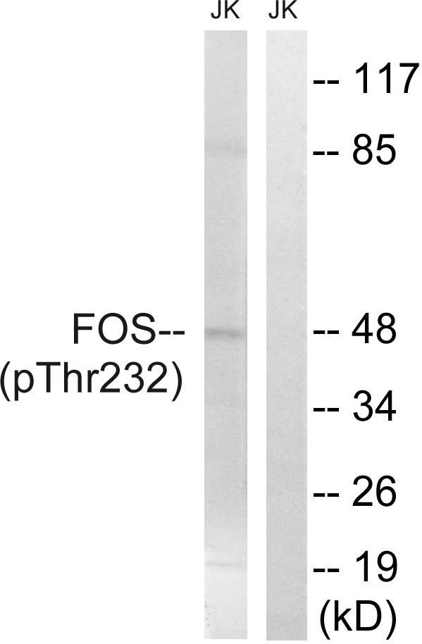 FOS / c-FOS Antibody - Western blot analysis of lysates from Jurkat cells treated with EGF 200ng/ml 5', using FOS (Phospho-Thr232) Antibody. The lane on the right is blocked with the phospho peptide.