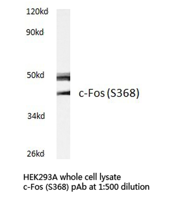 FOS / c-FOS Antibody - Western blot of c-Fos (S368) pAb in extracts from HEK293A cells.