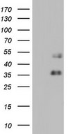 FOSB Antibody - HEK293T cells were transfected with the pCMV6-ENTRY control. (Left lane) or pCMV6-ENTRY FOSB. (Right lane) cDNA for 48 hrs and lysed. Equivalent amounts of cell lysates. (5 ug per lane) were separated by SDS-PAGE and immunoblotted with anti-FOSB.