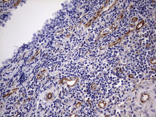 FOSB Antibody - Immunohistochemical staining of paraffin-embedded Human tonsil within the normal limits using anti-FOSB mouse monoclonal antibody.  Dilution: 1:150