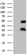 FOSB Antibody - HEK293T cells were transfected with the pCMV6-ENTRY control (Left lane) or pCMV6-ENTRY FOSB (Right lane) cDNA for 48 hrs and lysed. Equivalent amounts of cell lysates (5 ug per lane) were separated by SDS-PAGE and immunoblotted with anti-FOSB.