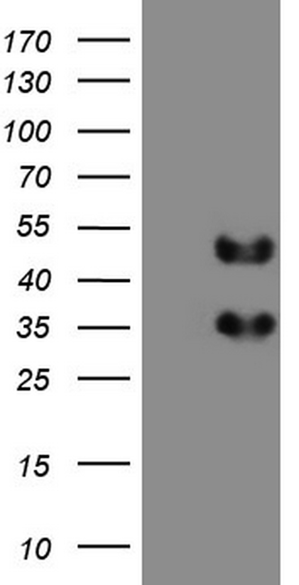 FOSB Antibody - HEK293T cells were transfected with the pCMV6-ENTRY control. (Left lane) or pCMV6-ENTRY FOSB. (Right lane) cDNA for 48 hrs and lysed. Equivalent amounts of cell lysates. (5 ug per lane) were separated by SDS-PAGE and immunoblotted with anti-FOSB.