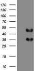 FOSB Antibody - HEK293T cells were transfected with the pCMV6-ENTRY control (Left lane) or pCMV6-ENTRY FOSB (Right lane) cDNA for 48 hrs and lysed. Equivalent amounts of cell lysates (5 ug per lane) were separated by SDS-PAGE and immunoblotted with anti-FOSB.