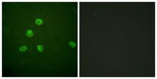 FOSB Antibody - Immunofluorescence analysis of HepG2 cells, using FosB Antibody. The picture on the right is blocked with the synthesized peptide.