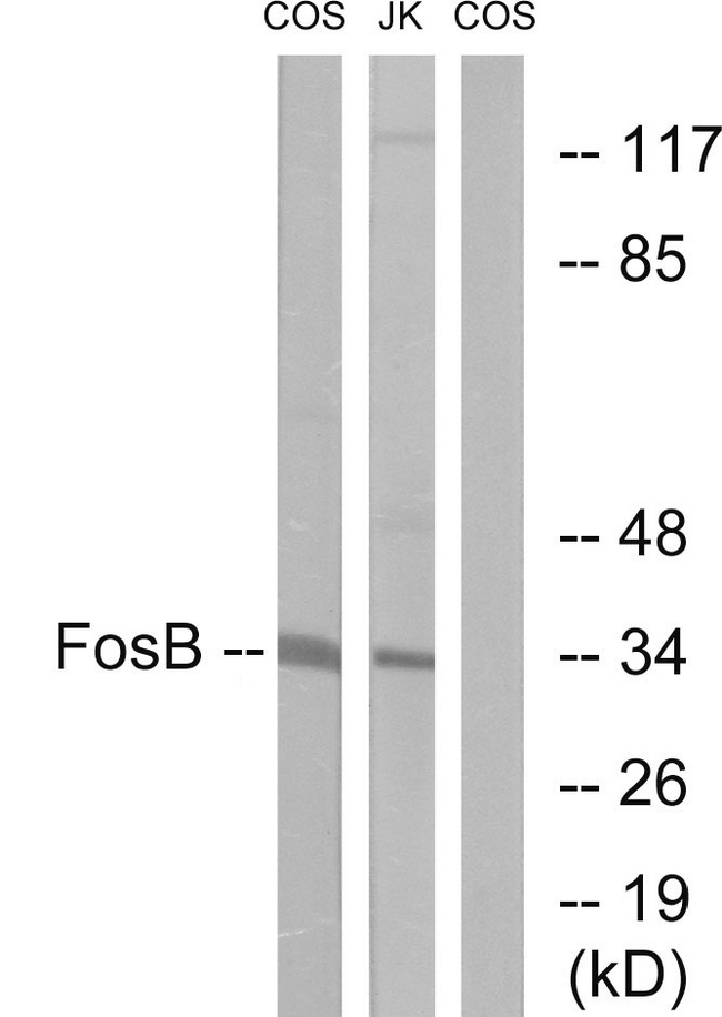 FOSB Antibody - Western blot analysis of lysates from COS7 and Jurkat cells, using FosB Antibody. The lane on the right is blocked with the synthesized peptide.