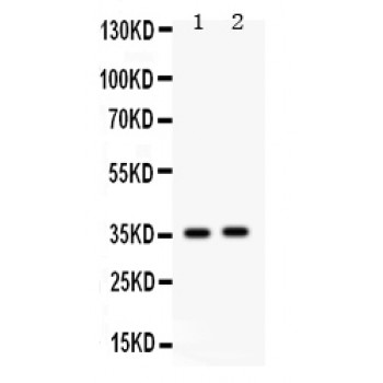 FOSB Antibody - Fos B antibody Western blot. All lanes: Anti Fos B at 0.5 ug/ml. Lane 1: Rat Kidney Tissue Lysate at 50 ug. Lane 2: HEPG2 Whole Cell Lysate at 40 ug. Predicted band size: 36 kD. Observed band size: 36 kD.