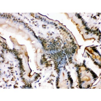 FOSB Antibody - Fos B antibody IHC-paraffin. IHC(P): Rat Intestine Tissue.