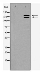 FOSB Antibody - Western blot of FosB expression in PMA treated COS7 whole cell lysates,The lane on the left is treated with the antigen-specific peptide.