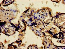 FOSB Antibody - Immunohistochemistry image of paraffin-embedded human placenta tissue at a dilution of 1:100