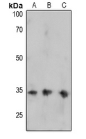 FOSB Antibody - Western blot analysis of FOSB (pS27) expression in HeLa (A), U87MG (B), PC3 (C) whole cell lysates.
