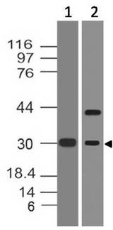FOSB Antibody - Fig-1: Western blot analysis of FOSB. Anti-FOSB antibody was used at 2 µg/ml on hKidney and mPlacenta lysates.