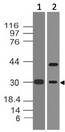FOSB Antibody - Fig-1: Western blot analysis of FOSB. Anti-FOSB antibody was used at 2 µg/ml on hKidney and mPlacenta lysates.