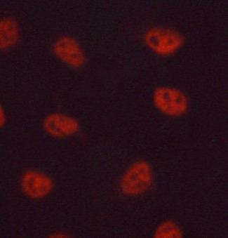 FOSB Antibody - Staining MCF-7 cells by IF/ICC. The samples were fixed with PFA and permeabilized in 0.1% saponin prior to blocking in 10% serum for 45 min at 37°C. The primary antibody was diluted 1/400 and incubated with the sample for 1 hour at 37°C. A Alexa Fluor® 594 conjugated goat polyclonal to rabbit IgG (H+L), diluted 1/600 was used as secondary antibody.