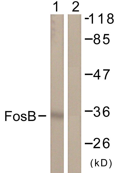 FOSB Antibody - Western blot analysis of extracts from COS7 cells, using FosB (Ab-27) antibody.