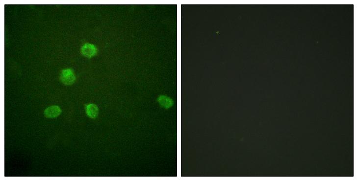 FOSB Antibody - Peptide - + Immunofluorescence analysis of HepG2 cells, using FosB (Ab-27) antibody.