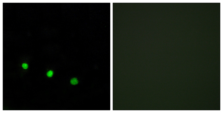 FOSB Antibody - Immunofluorescence analysis of HUVEC cells treated with EGF 200nM 5', using FosB (Phospho-Ser27) Antibody. The picture on the right is blocked with the phospho peptide.