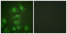 FOSB Antibody - EGF + - Immunofluorescence analysis of HuvEc cells, treated with EGF (200nM, 5mins), using FosB (Phospho-Ser27) antibody.