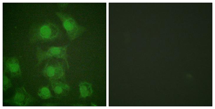FOSB Antibody - EGF + - Immunofluorescence analysis of HuvEc cells, treated with EGF (200nM, 5mins), using FosB (Phospho-Ser27) antibody.