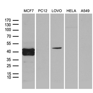 FOSL2 / FRA-2 Antibody - Western blot analysis of extracts. (35ug) from 5 different cell lines by using anti-FOSL2 monoclonal antibody. (1:500)