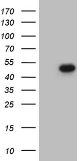 FOSL2 / FRA-2 Antibody - HEK293T cells were transfected with the pCMV6-ENTRY control. (Left lane) or pCMV6-ENTRY FOSL2. (Right lane) cDNA for 48 hrs and lysed. Equivalent amounts of cell lysates. (5 ug per lane) were separated by SDS-PAGE and immunoblotted with anti-FOSL2. (1:2000)