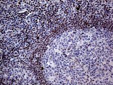 FOSL2 / FRA-2 Antibody - Immunohistochemical staining of paraffin-embedded Human lymph node tissue within the normal limits using anti-FOSL2 mouse monoclonal antibody. (Heat-induced epitope retrieval by 1mM EDTA in 10mM Tris buffer. (pH8.5) at 120°C for 3 min. (1:2000)