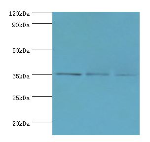 FOSL2 / FRA-2 Antibody - Western blot. All lanes: FOSL2 antibody at 8 ug/ml. Lane 1: MCF-7 whole cell lysate. Lane 2: Jurkat whole cell lysate. Lane 3: PC-3 whole cell lysate. Secondary antibody: Goat polyclonal to rabbit at 1:10000 dilution. Predicted band size: 35 kDa. Observed band size: 35 kDa.