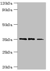 FOSL2 / FRA-2 Antibody - Western blot All lanes: FOSL2 antibody at 8µg/ml Lane 1: MCF-7 whole cell lysate Lane 2: Jurkat whole cell lysate Lane 3: PC-3 whole cell lysate Secondary Goat polyclonal to rabbit IgG at 1/10000 dilution Predicted band size: 36, 35, 32 kDa Observed band size: 36 kDa