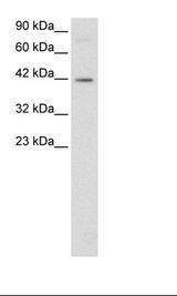 FOSL2 / FRA-2 Antibody - Jurkat Cell Lysate.  This image was taken for the unconjugated form of this product. Other forms have not been tested.