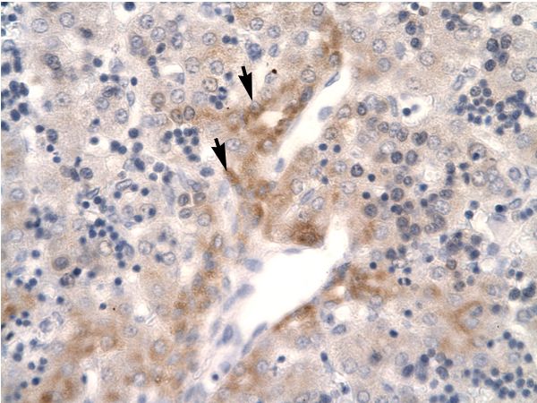 FOSL2 / FRA-2 Antibody - FOSL2 / FRA2 antibody ARP31277_P050-NP_005244-FOSL2 (FOS-like antigen 2) Antibody was used in IHC to stain formalin-fixed, paraffin-embedded human liver.  This image was taken for the unconjugated form of this product. Other forms have not been tested.