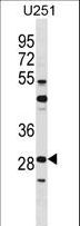 FOSL2 / FRA-2 Antibody - FOSL2 Antibody western blot of U251 cell line lysates (35 ug/lane). The FOSL2 antibody detected the FOSL2 protein (arrow).