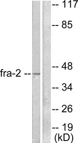FOSL2 / FRA-2 Antibody - Western blot analysis of lysates from LOVO cells, using Fra-2 Antibody. The lane on the right is blocked with the synthesized peptide.
