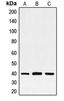 FOSL2 / FRA-2 Antibody - Western blot analysis of FRA2 expression in HeLa (A); MCF7 (B); PC12 (C) whole cell lysates.