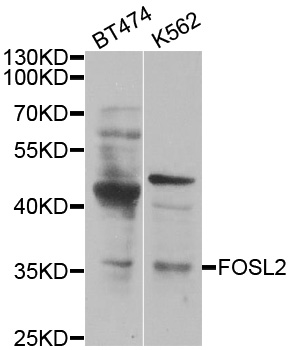 FOSL2 / FRA-2 Antibody - Western blot analysis of extracts of 231 cell line, using FOSL2 antibody.
