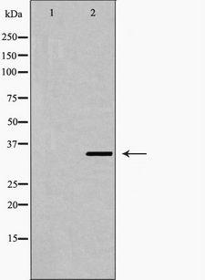 FOSL2 / FRA-2 Antibody - Western blot analysis of Fra 2 expression in LOVO cells extract. The lane on the left is treated with the antigen-specific peptide.