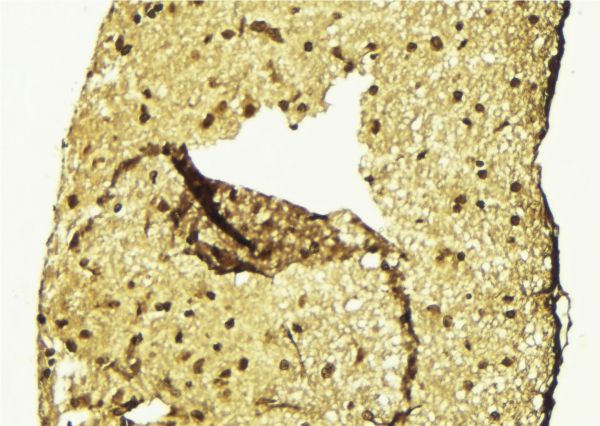FOSL2 / FRA-2 Antibody - 1:100 staining mouse brain tissue by IHC-P. The sample was formaldehyde fixed and a heat mediated antigen retrieval step in citrate buffer was performed. The sample was then blocked and incubated with the antibody for 1.5 hours at 22°C. An HRP conjugated goat anti-rabbit antibody was used as the secondary.