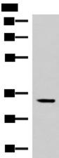 FOSL2 / FRA-2 Antibody - Western blot analysis of Mouse adrenal gland tissue lysate  using FOSL2 Polyclonal Antibody at dilution of 1:550