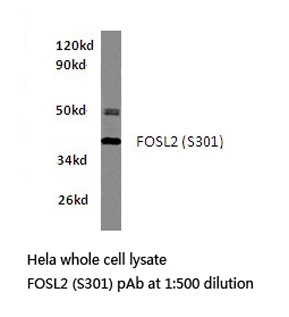 FOSL2 / FRA-2 Antibody - Western blot of Fra-2/FOSL2 (S301) pAb in extracts from HeLa cells.