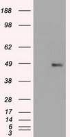 FOXA1 Antibody - HEK293T cells were transfected with the pCMV6-ENTRY control (Left lane) or pCMV6-ENTRY FOXA1 (Right lane) cDNA for 48 hrs and lysed. Equivalent amounts of cell lysates (5 ug per lane) were separated by SDS-PAGE and immunoblotted with anti-FOXA1.