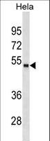 FOXA1 Antibody - FOXA1 Antibody (Center D159)(Ascites)western blot of HeLa cell line lysates (35 ug/lane). The FOXA1 antibody detected the FOXA1 protein (arrow).