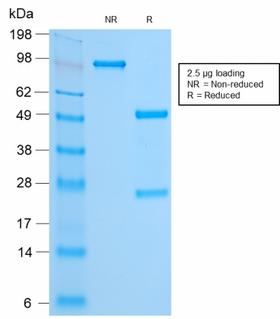 FOXA1 Antibody - SDS-PAGE Analysis Purified FOXA1 Rabbit Recombinant Monoclonal Antibody (FOXA1/2230R). Confirmation of Purity and Integrity of Antibody.
