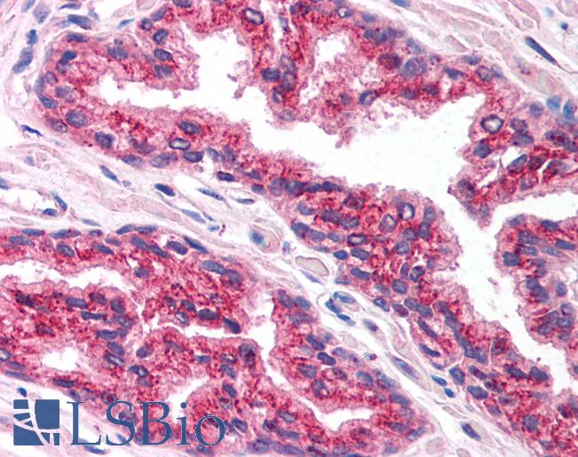 FOXA1 Antibody - Anti-FOXA1 antibody IHC of human prostate. Immunohistochemistry of formalin-fixed, paraffin-embedded tissue after heat-induced antigen retrieval. Antibody concentration 5 ug/ml.  This image was taken for the unconjugated form of this product. Other forms have not been tested.
